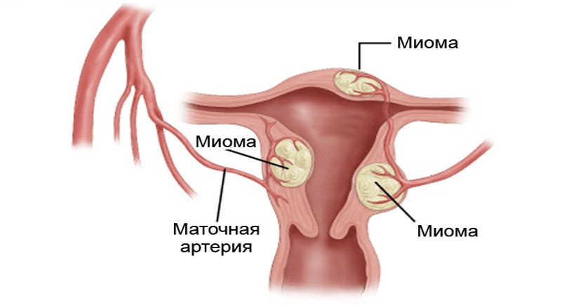 постоянно хочется в туалет по маленькому женщина